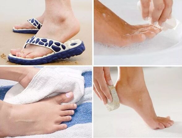 Prevention