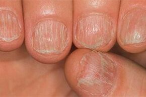 The fungus damage