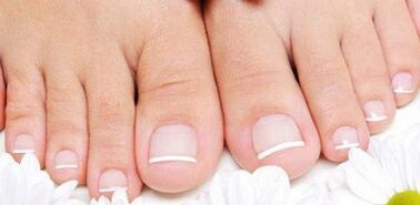 Prevention of the appearance of fungus on the nails of the feet