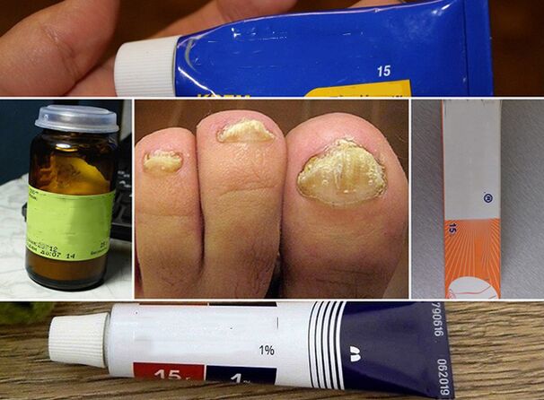 General Principles to treat fungus