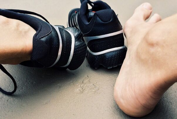 The causes of the appearance of the fungus of the legs